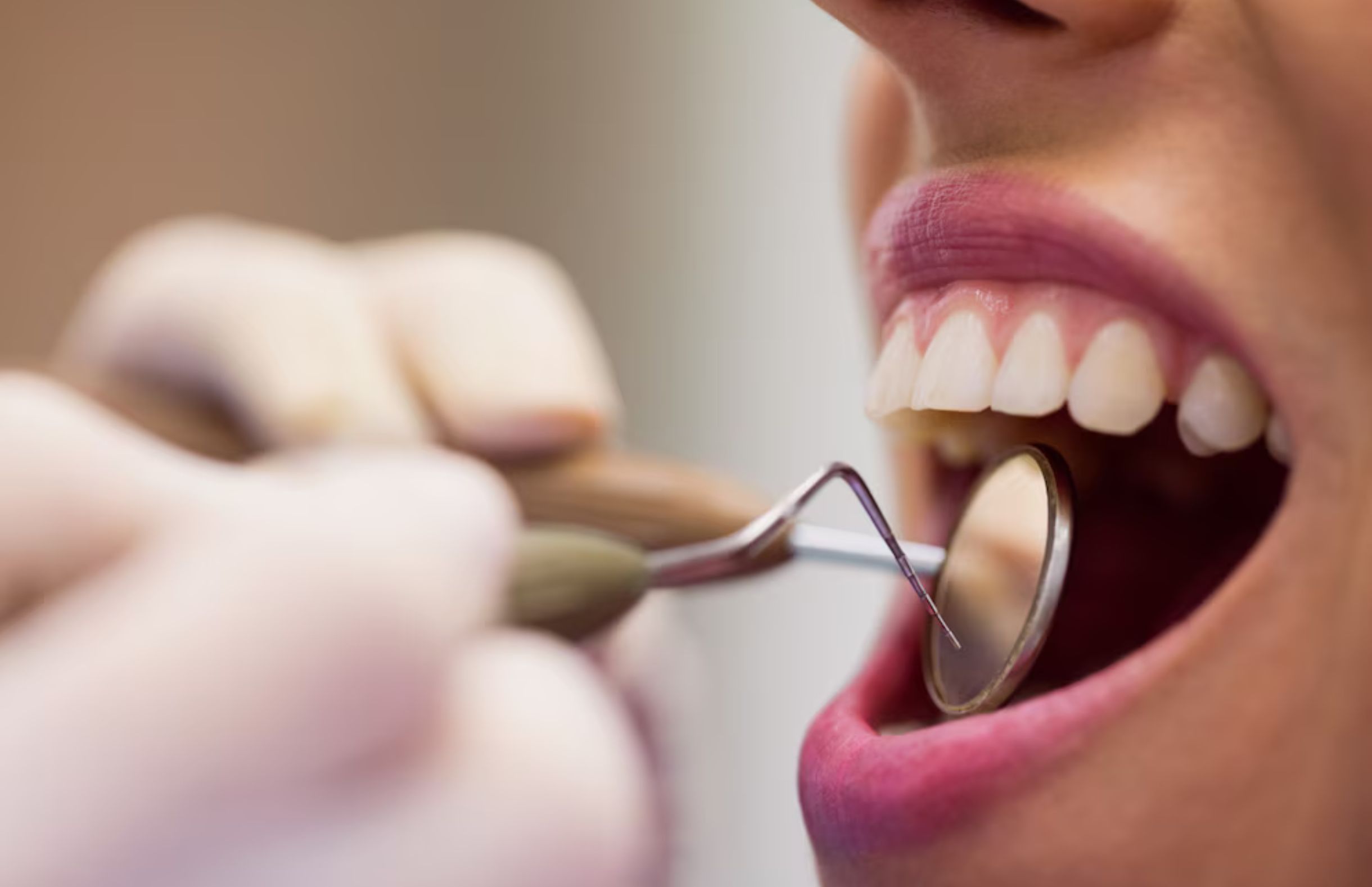Dor de dente pode ser evitada: UPA Engenho Velho alerta para os riscos da falta de prevenção no Dia Mundial da Saúde Bucal