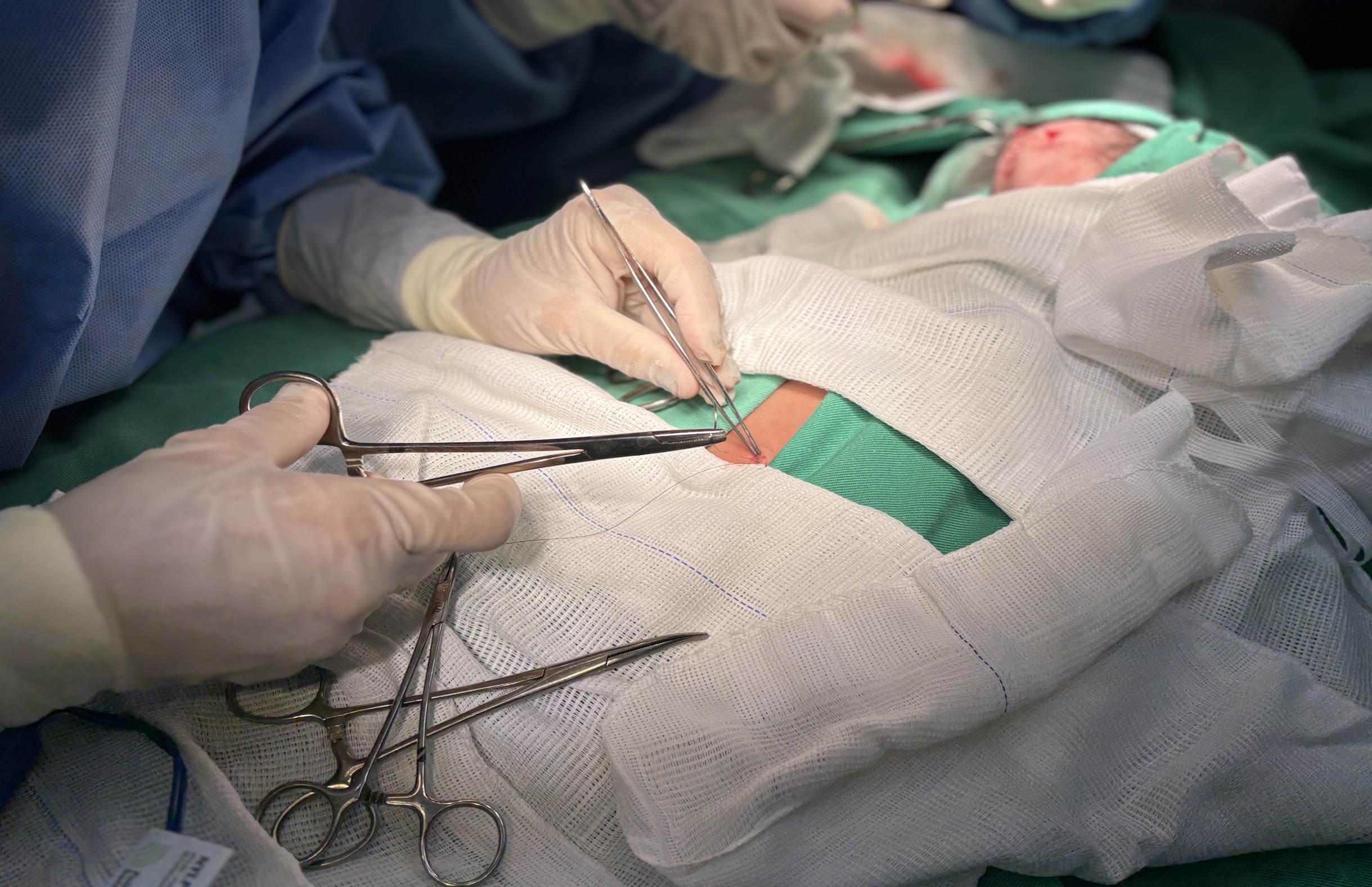 Hospital Maria Lucinda realiza primeiras cirurgias neurológicas com apoio do Programa Cuida PE